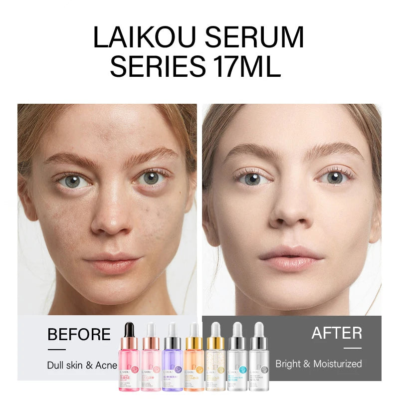 🌟 LAIKOU Sérum Visage 7 Flacons – 24K Or, Escargot, Sakura, Acide Hyaluronique, Vitamine C & Niacinamide